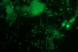 IPROMA presentará un proyecto de investigación sobre técnica FISH en el XI Congreso Internacional AEDyR