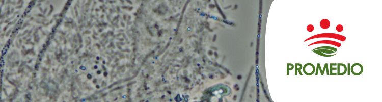 Bacterias “glotonas”, las protagonistas del tratamiento de las aguas residuales