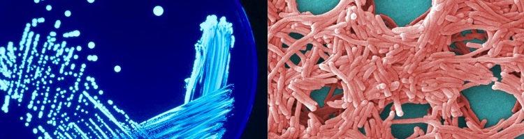 La legionella, el visitante no deseado del verano: síntomas, prevención, desinfección