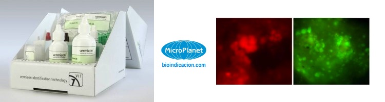 El kit microbiológico Nitri-VIT® se actualiza para detectar la bacteria Nitrotoga, fundamental en la oxidación de los nitritos en EDAR