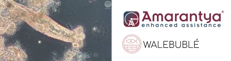 AMARANTYA, la nueva app innovadora para el análisis microbiológico de fangos activos en EDAR